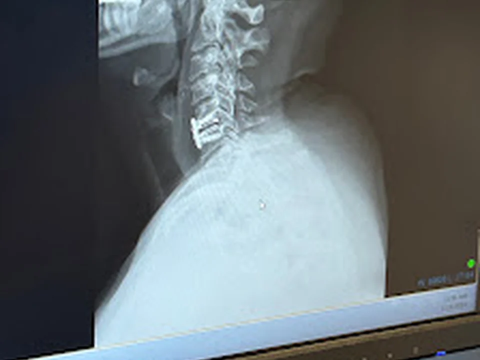Foto de Max Steuer, MD