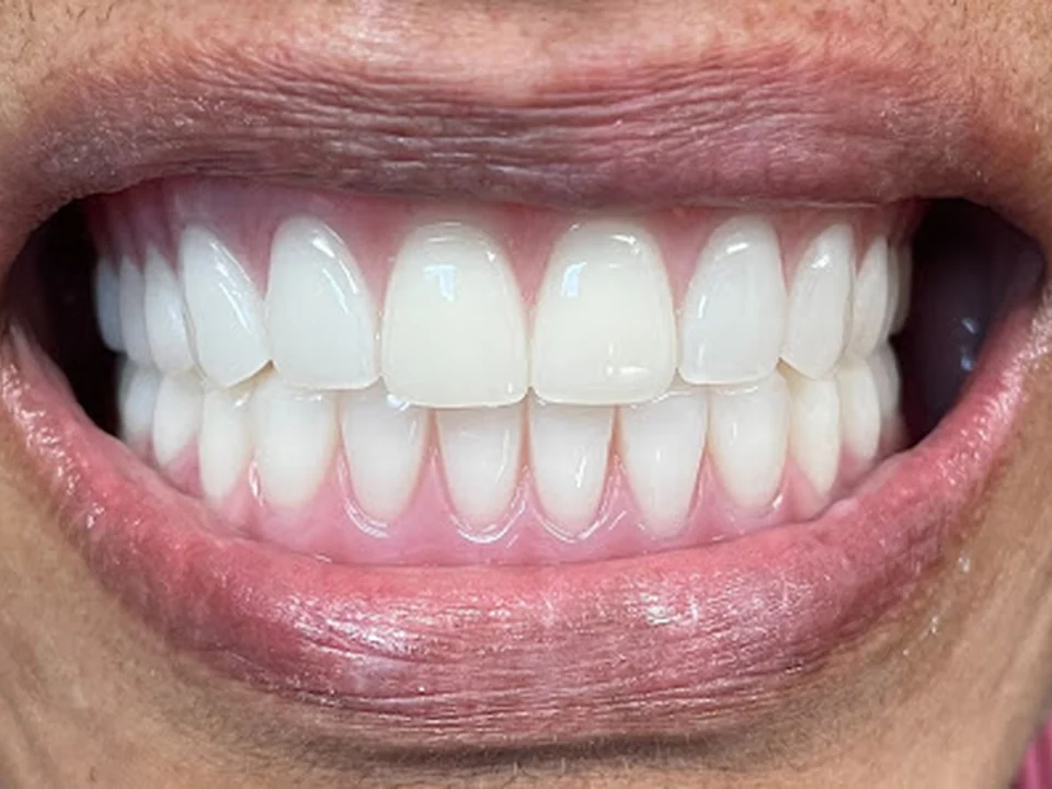 TITANIUM DENTAL Implants & Periodontics **$1,999 Implant Special** Best Price in GA!
